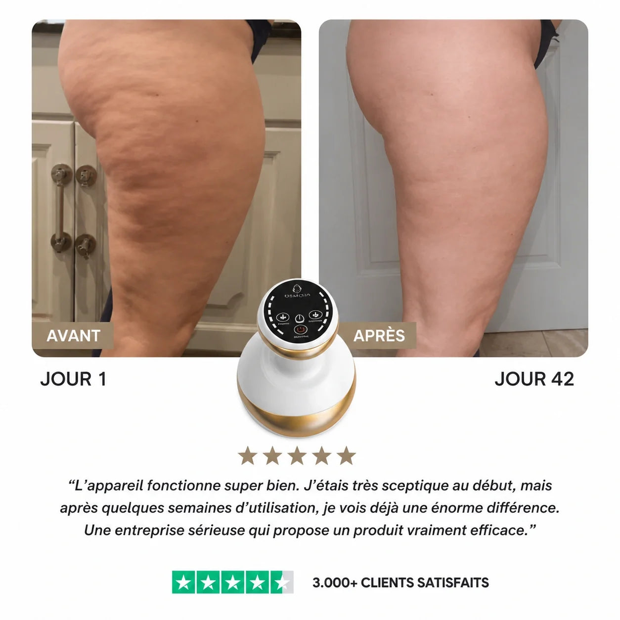 Osmotia™ | Appareil de massage anti-cellulite