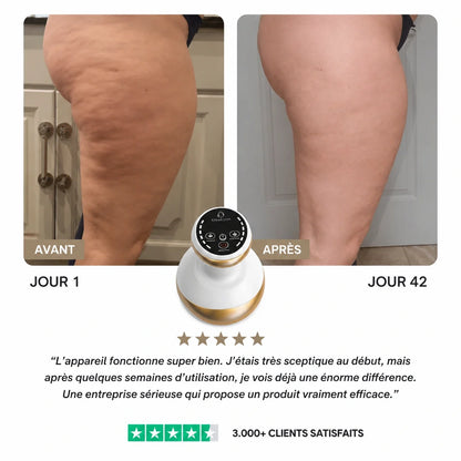 Osmotia™ | Appareil de massage anti-cellulite