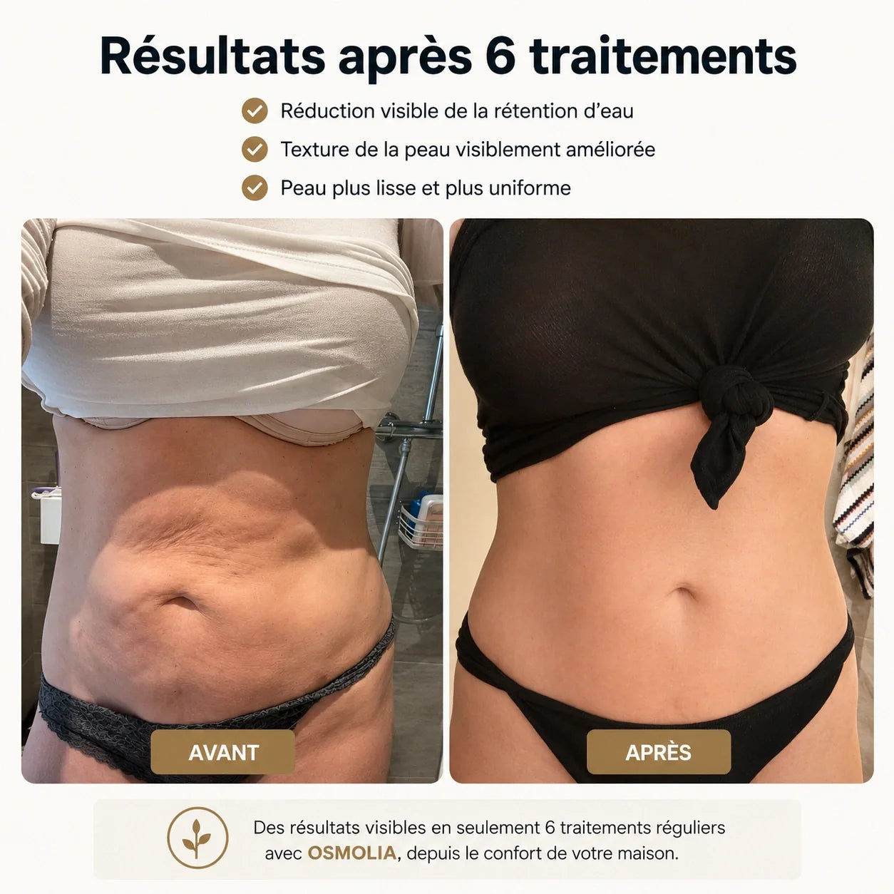 Osmotia™ | Appareil de massage anti-cellulite