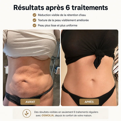 Osmotia™ | Appareil de massage anti-cellulite