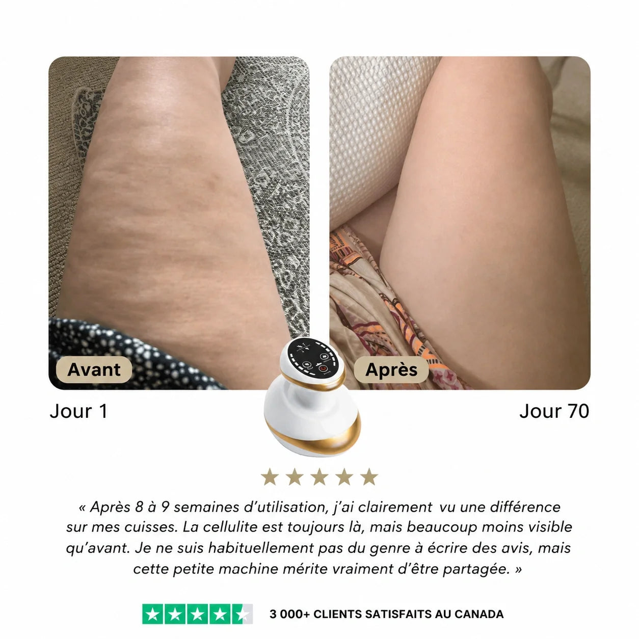 Osmotia™ | Appareil de massage anti-cellulite